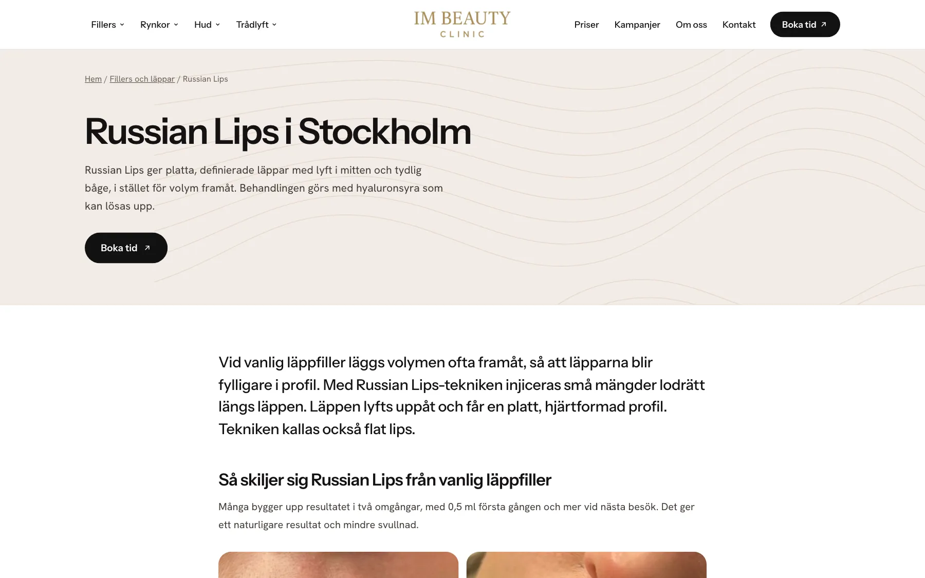 Sidan om Russian Lips hos IM Beauty Clinic