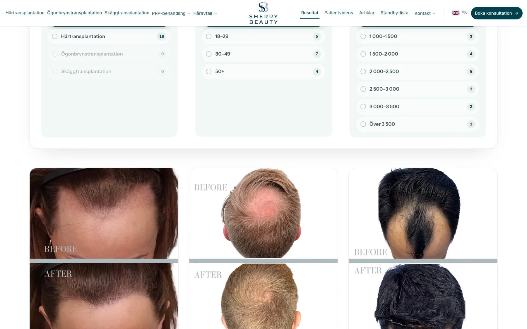 The results page with before and after photos and filters at Sherry Beauty